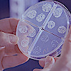 Microbiology plate. Original image from CDC via unsplash.com